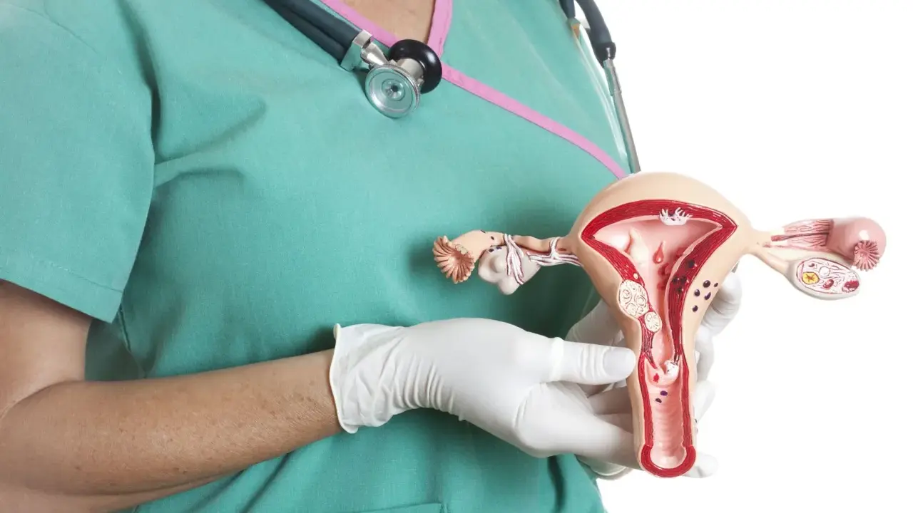 Model macicy z widocznymi mięśniakami. Lekarz w rękawiczkach pokazuje anatomiczny model, ilustrujący problem mięśniaków macicy.