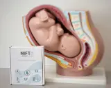 Model anatomiczny płodu w macicy obok pudełka testu NIFTY. Badanie NIFTY to nieinwazyjny test prenatalny.