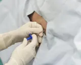 Rękawiczki medyczne zakładane są do podania znieczulenia epiduralnego.