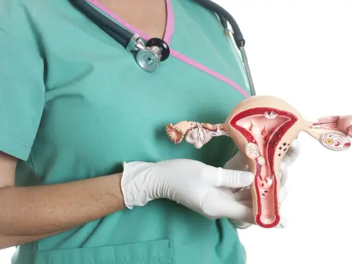 Model macicy z widocznymi mięśniakami. Lekarz w rękawiczkach pokazuje anatomiczny model, ilustrujący problem mięśniaków macicy.